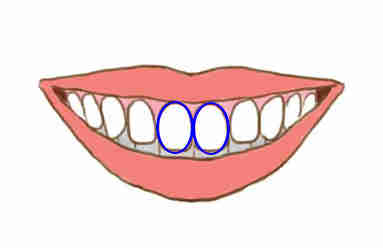 tipos_de_dientes_01