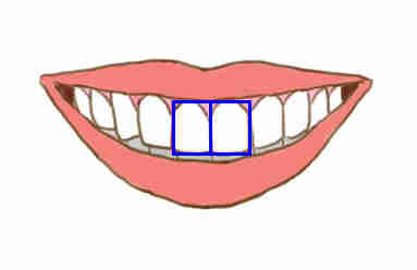 tipos_de_dientes_01